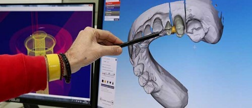 ODONTOTECNICI – Profilo professionale